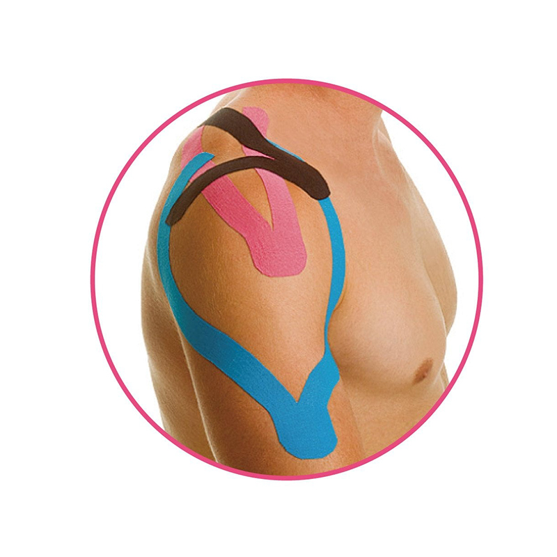 תיקון קינסיולוגיה I סוג