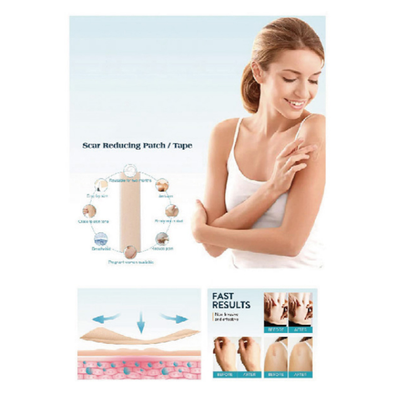 חבישה מסיליקון